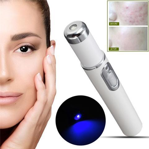 "Blue Light Therapy Acne Laser Pen for Scar and Wrinkle Removal"